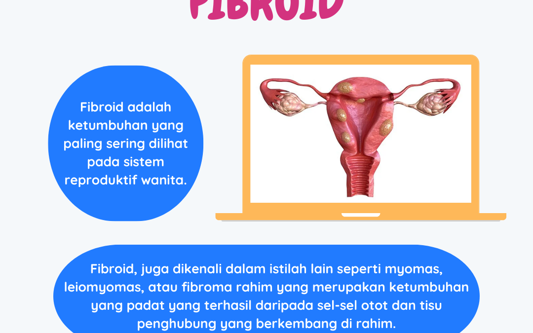 FIBROID