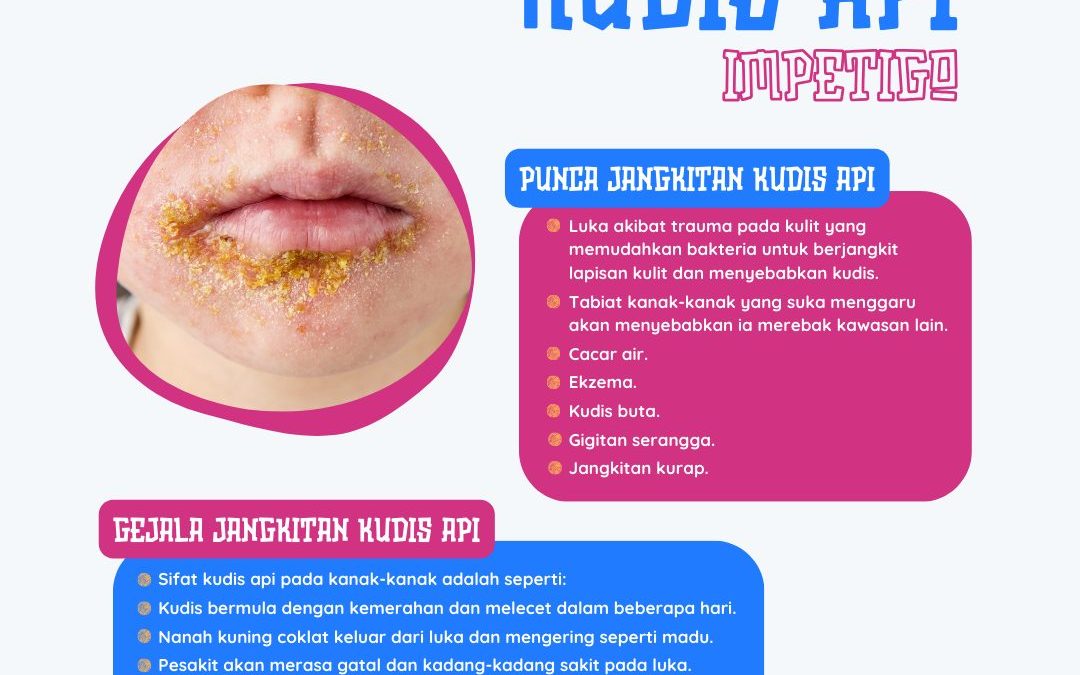 KUDIS API (IMPETIGO)